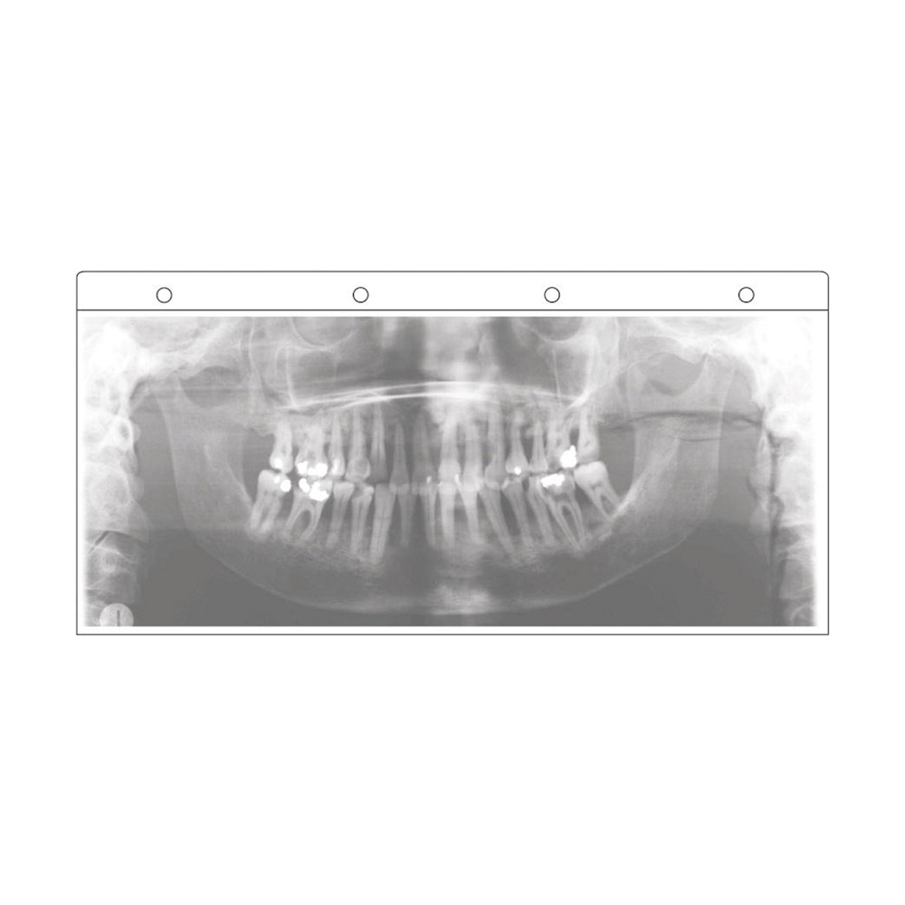 picodent Majesthetik-Gingiimplant - Set 2 x 50 ml double cartridge including, 12 Mischkanülen